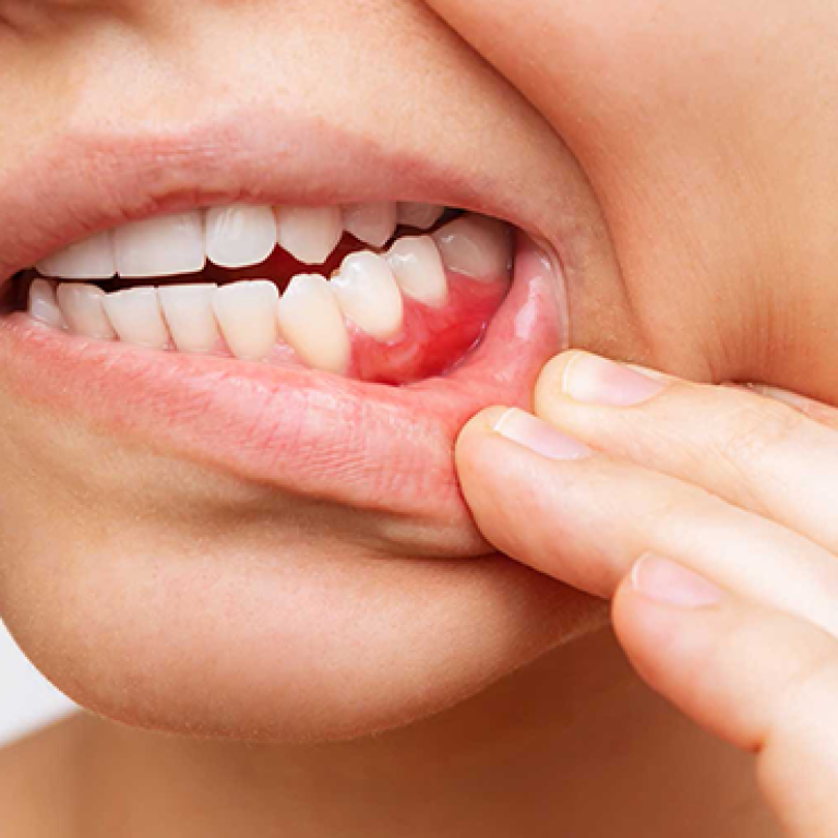 20231221-dis-eti-bakimi-nasil-yapilmalidir-969340-4f25c5a8abddda43896a